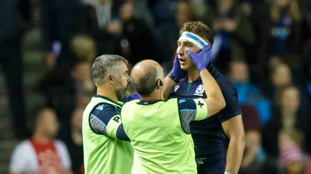 Jamie Ritchie se perderá el debut de Escocia por lesión